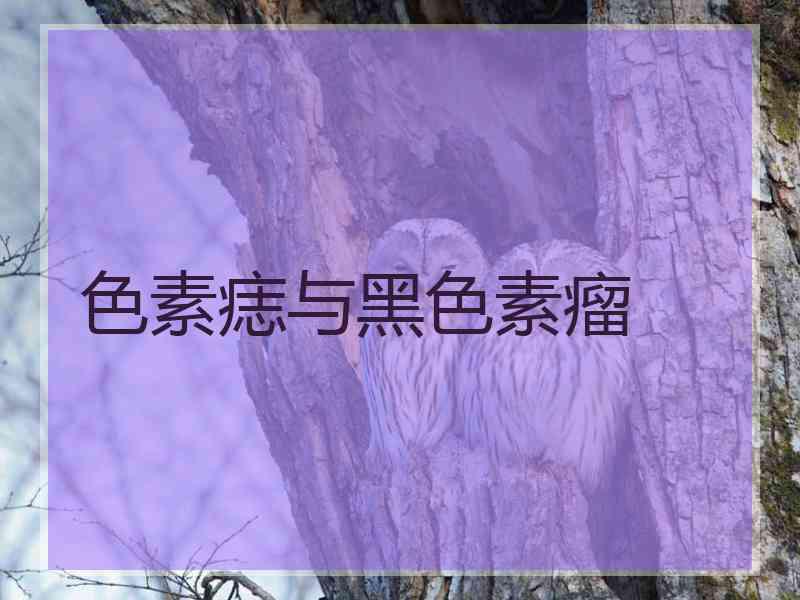 色素痣与黑色素瘤